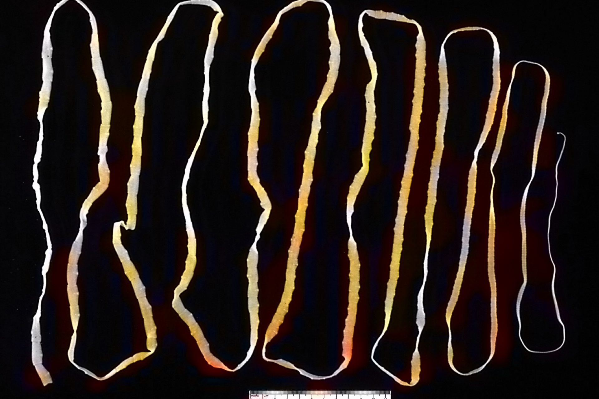 Tapeworms go to disturbing lengths  