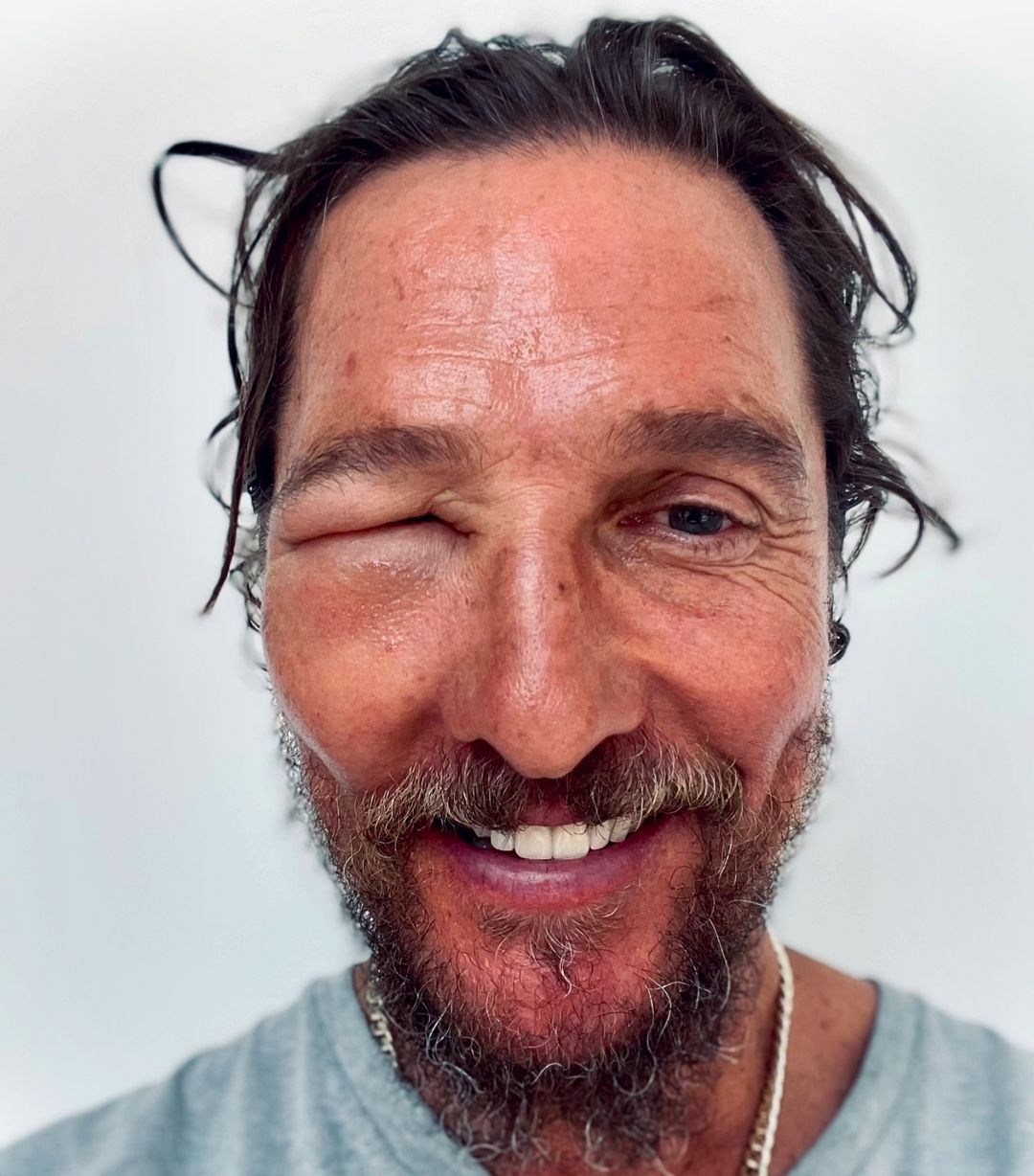 Matthew McConaughey's weird accident... He takes it with humor!